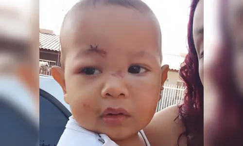 Bebê ficou com ferimentos no rosto: 'Mão de Deus'